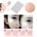 36 Posts/bag Acne Treatment Patch